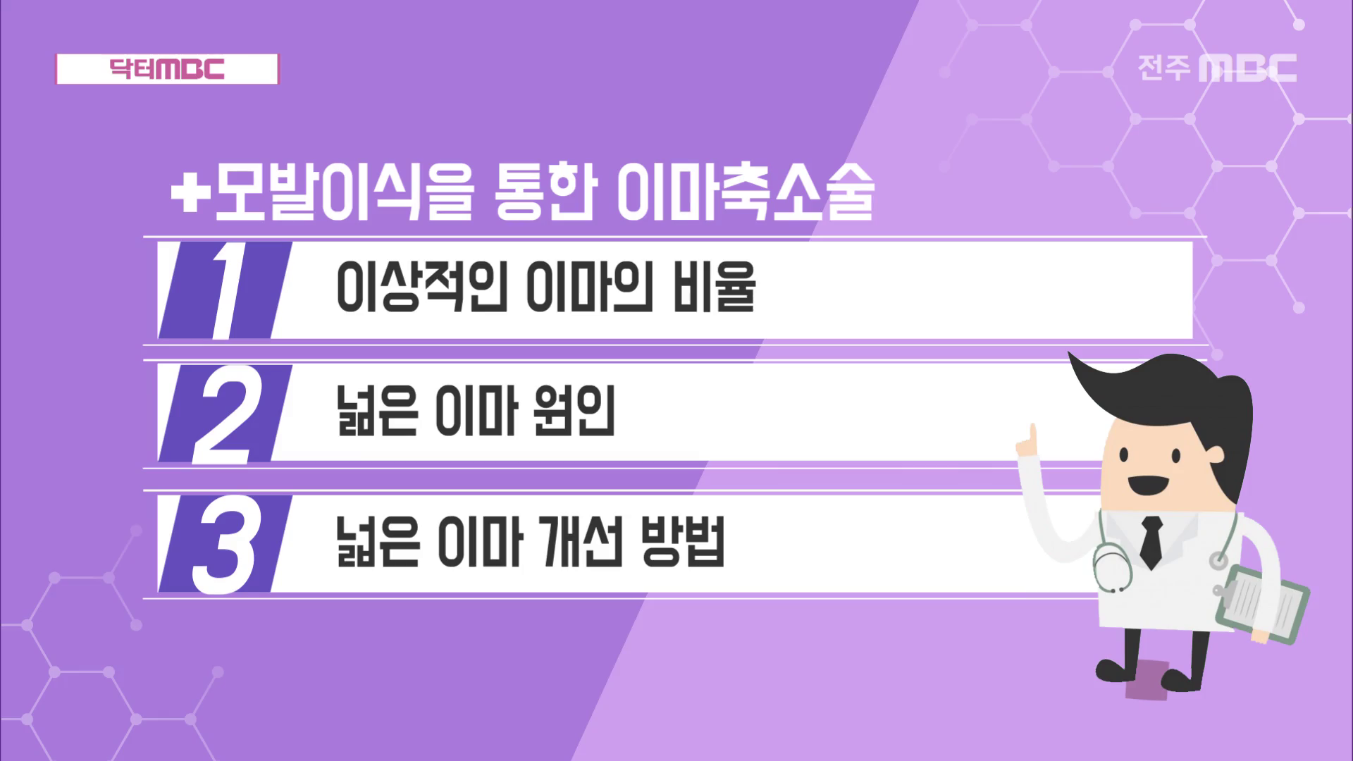 모발이식을 통한 이마축소술