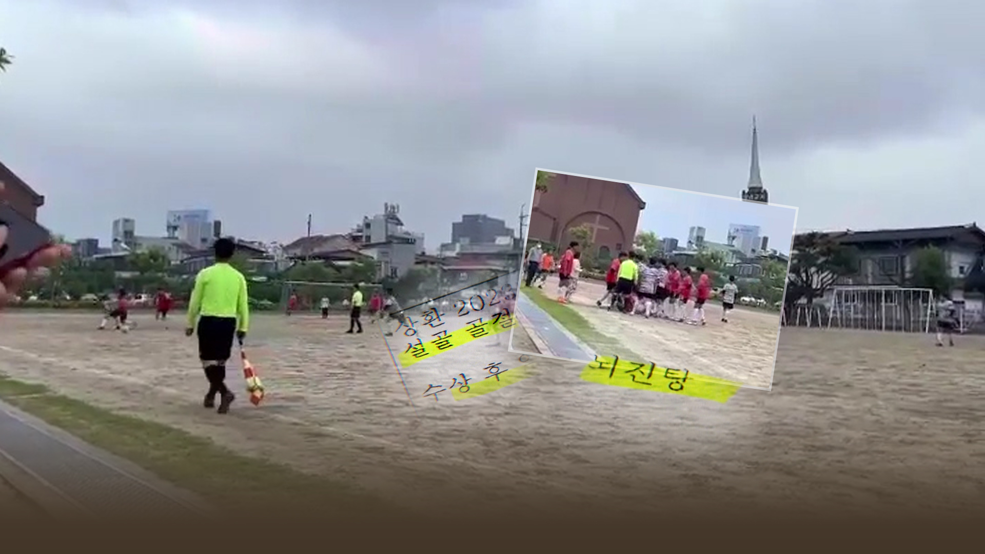 뇌진탕에 치아 손상됐는데..