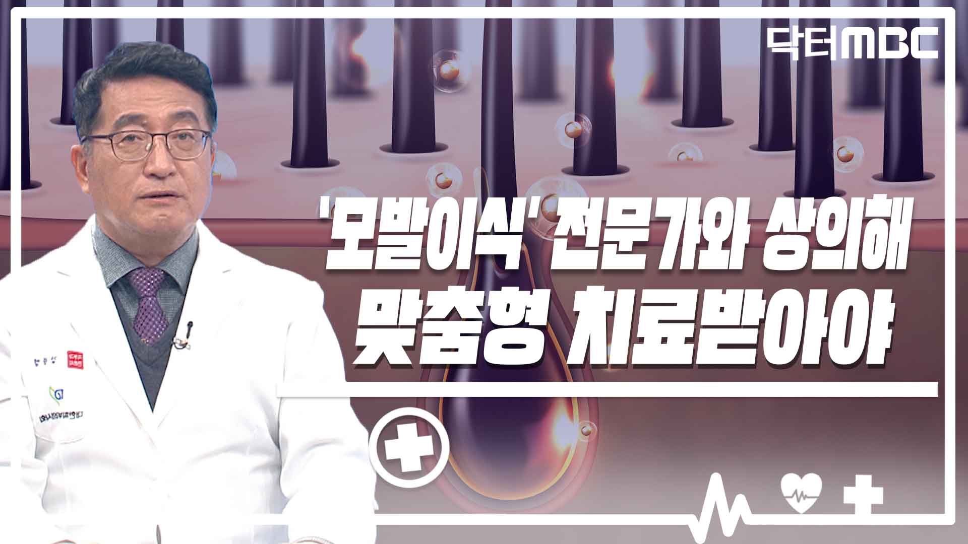 모발이식 전문가와 상의해 맞춤형 치료받아야 [닥터M]