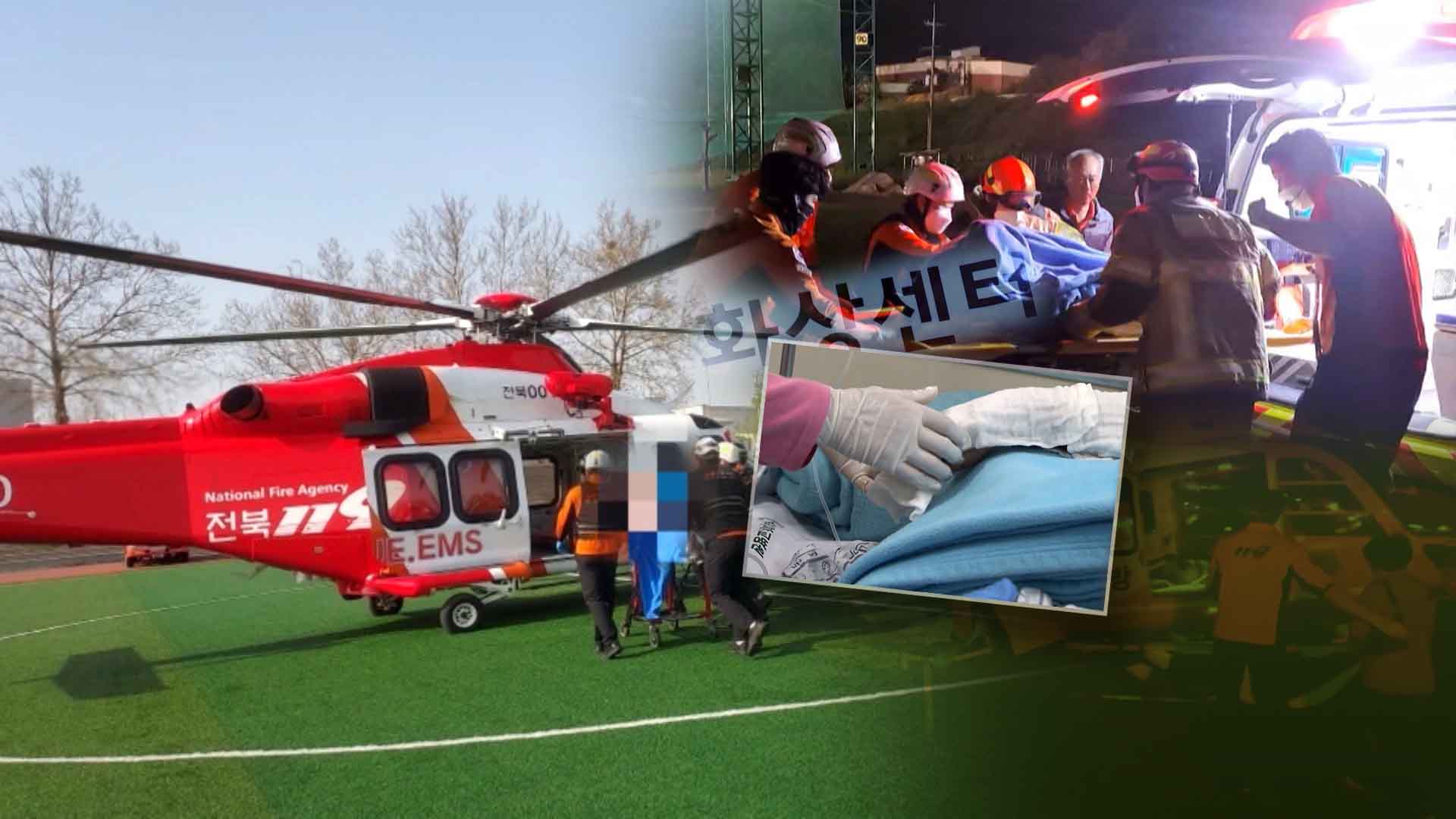 전북, 화상 전문 병원 '0곳'.. 중증 환자 타 지역 이송 증가세