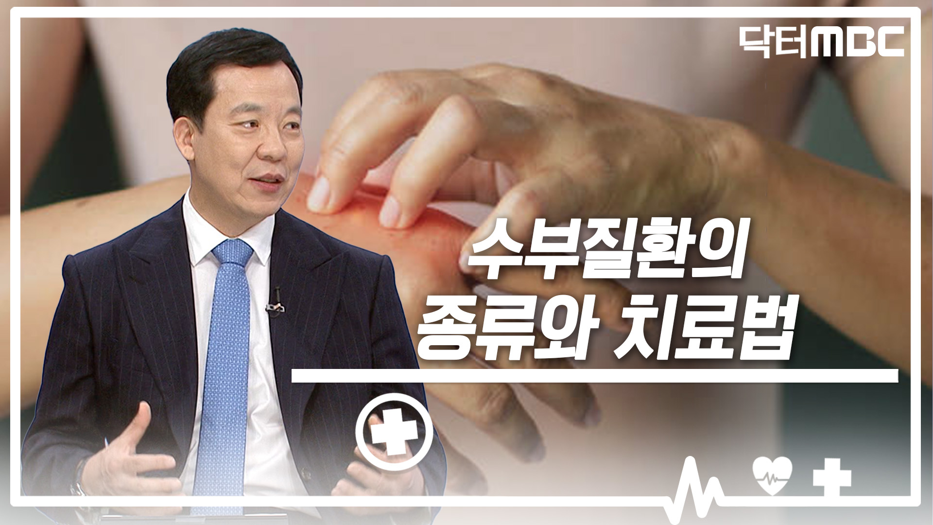 [닥터M] 수부질환의 종류와 치료법