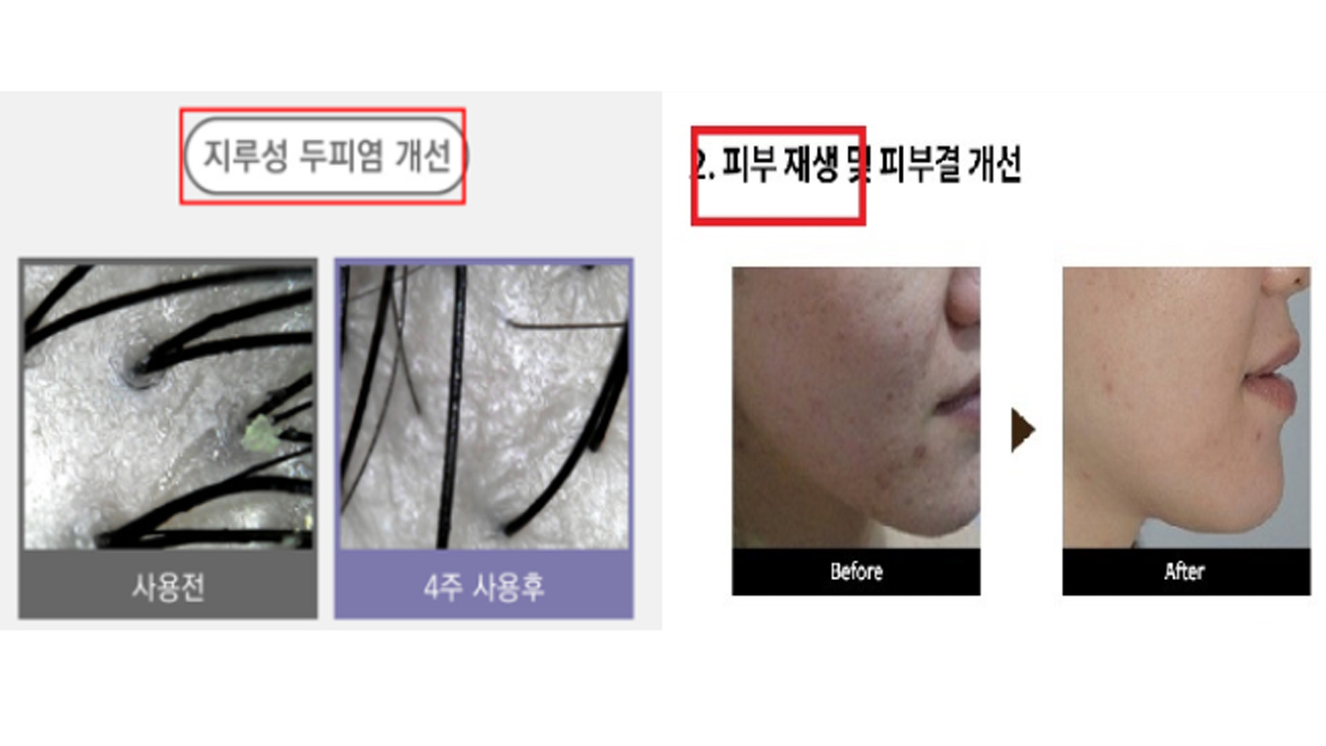 화장품 허위·과대 광고 324건 적발.. 