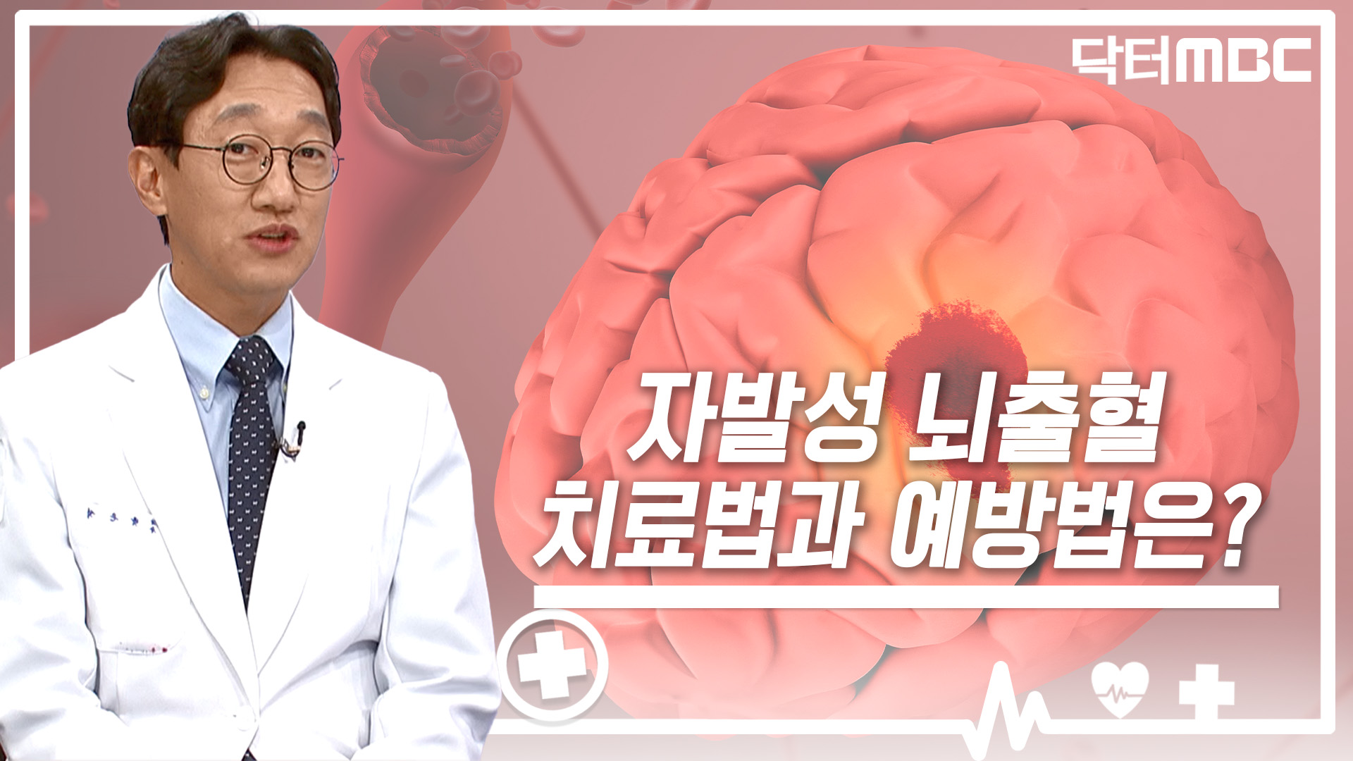 [닥터M] 소리 없이 찾아오는 '자발성 뇌출혈'.. 예방법은?