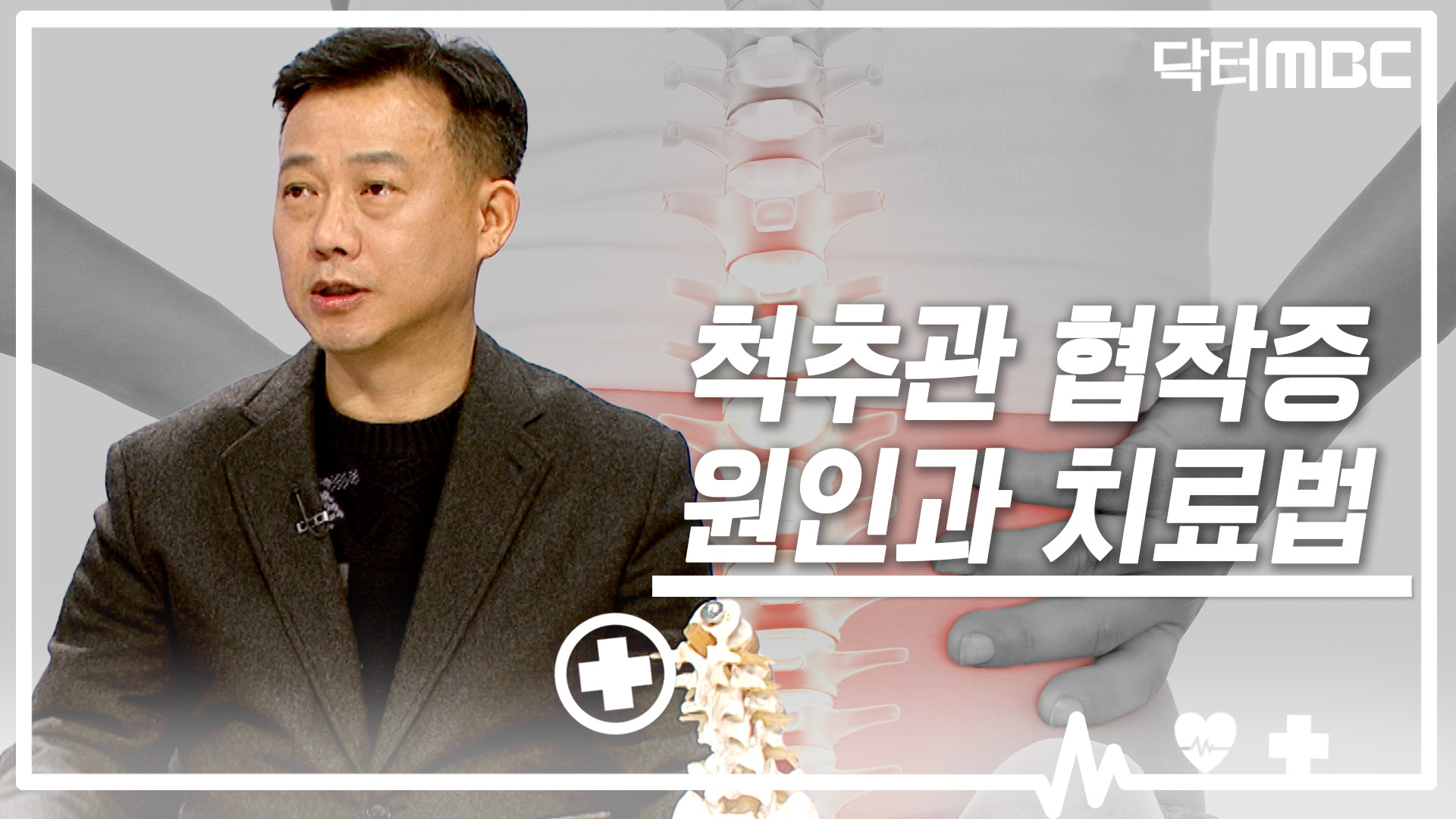 [닥터M] 척추관 협착증 원인과 치료법