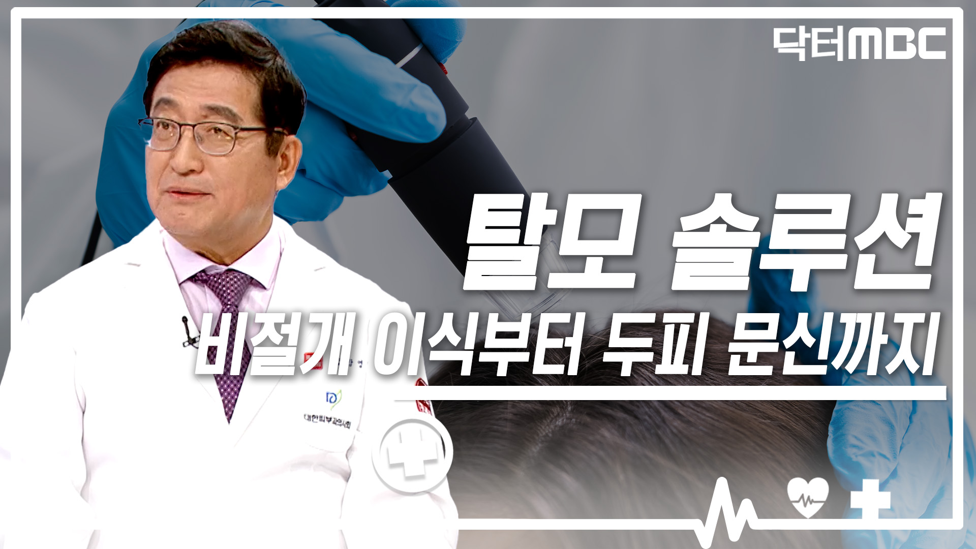 [닥터M] 탈모 솔루션, 비절개 이식부터 두피 문신까지