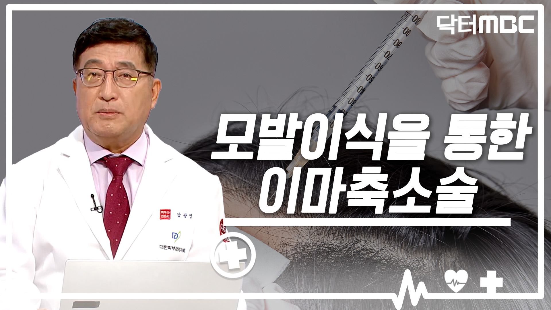 [닥터M] 모발이식을 통한 이마축소술