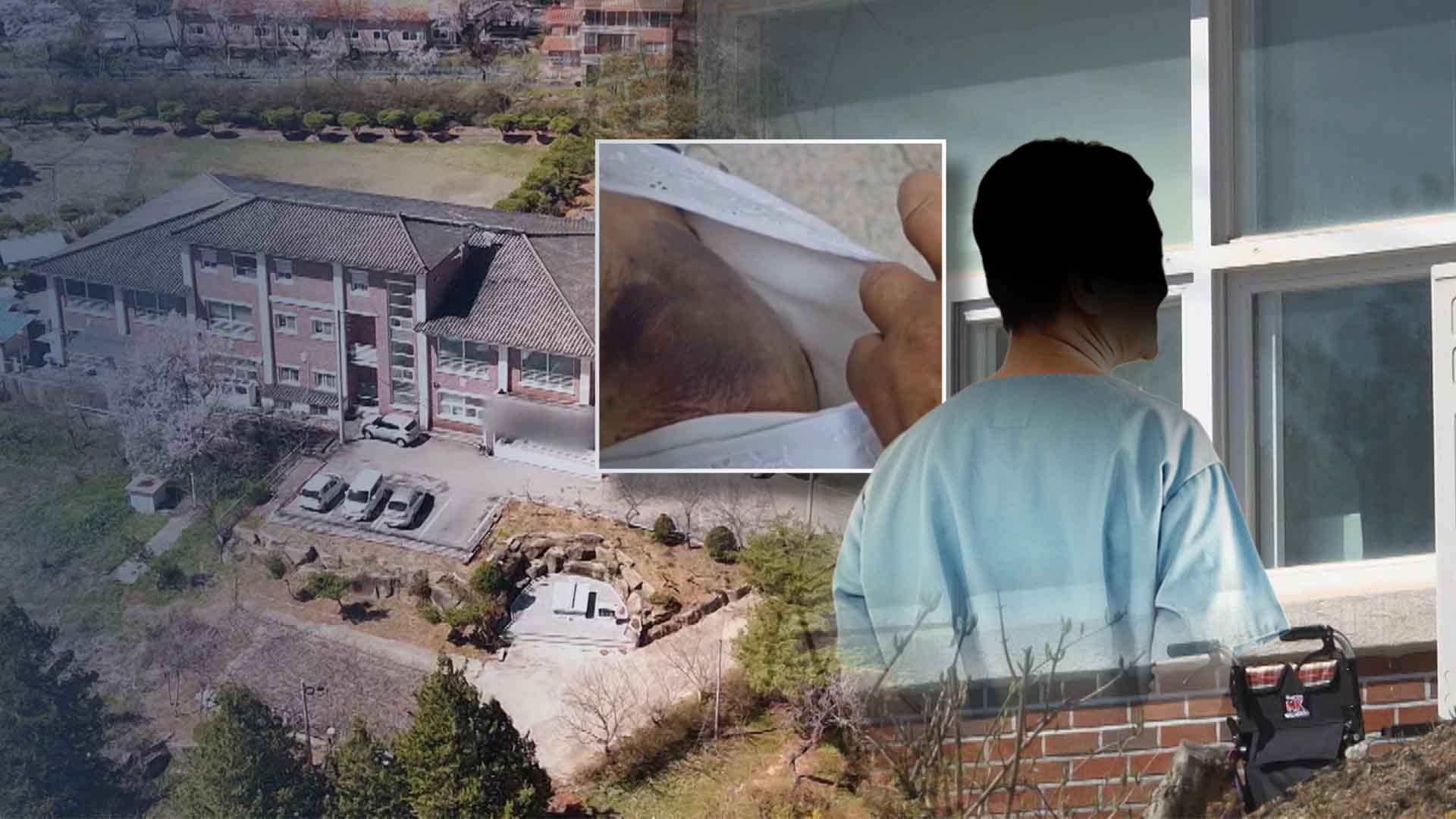 보호사가 내동댕이쳐 90대 골절.. 요양원은 닷새 동안 파스만